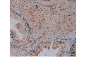 IHC-P analysis of Human Prostate Gland Tissue, with DAB staining. (Corin antibody  (AA 134-573))
