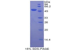 SDS-PAGE (SDS) image for Apolipoprotein D (APOD) (AA 1-189) protein (His tag,GST tag) (ABIN2122439)