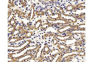 Immunohistochemistry (Paraffin-embedded Sections) (IHC (p)) image for anti-NF-kappa-B inhibitor beta (NFKBIB) antibody (ABIN7249640)