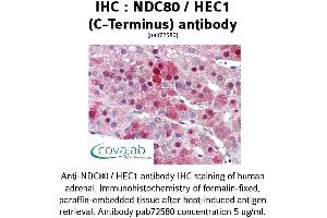 Image no. 1 for anti-NDC80 Kinetochore Complex Component Homolog (NDC80) (C-Term) antibody (ABIN1737233)