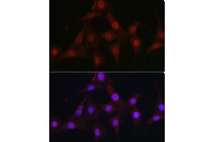 Immunofluorescence analysis of NIH/3T3 cells using C9orf72 Rabbit pAb (ABIN7266391) at dilution of 1:100 (40x lens). (C9ORF72 antibody  (AA 1-230))