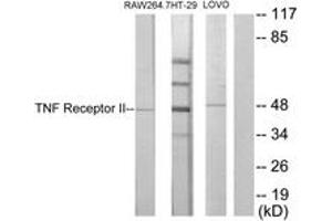 Western blot analysis of extracts from RAW264. (TNFRSF1B antibody  (AA 376-425))