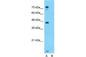 Host:  Rabbit  Target Name:  EPX  Sample Type:  MCF7  Lane A:  Primary Antibody  Lane B:  Primary Antibody + Blocking Peptide  Primary Antibody Concentration:  1ug/ml  Peptide Concentration:  5ug/ml  Lysate Quantity:  25ug/lane/lane  Gel Concentration:  0. (EPX antibody  (Middle Region))