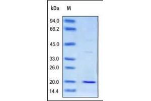 SDS-PAGE (SDS) image for CD3 epsilon (CD3E) (AA 22-117) (Active) protein (His tag) (ABIN2180774) (CD3 epsilon Protein (CD3E) (AA 22-117) (His tag))
