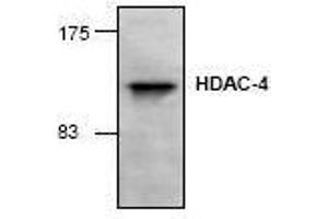 Image no. 1 for anti-Histone Deacetylase 4 (HDAC4) antibody (ABIN127238) (HDAC4 antibody)