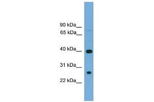 WB Suggested Anti-TREML2 Antibody Titration:  0. (TREML2 antibody  (N-Term))