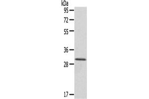 Western Blotting (WB) image for anti-HIV-1 Tat Interactive Protein 2, 30kDa (HTATIP2) antibody (ABIN5956861)