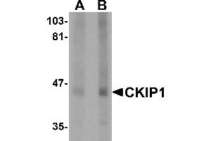 Western blot analysis of CKIP1 in human lung tissue lysate with CKIP1 antibody at (A) 1 and (B) 2 µg/mL.
