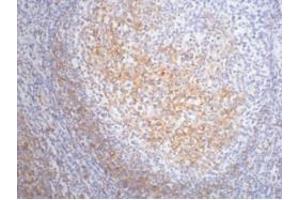 IHC staining of Human tonsil tissue paraffin-embedded, diluted at 1:200. (FCER2 antibody)