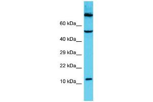 Host: Rabbit Target Name: C9orf16 Sample Type: HCT15 Whole Cell lysates Antibody Dilution: 1. (C9orf16 antibody  (Middle Region))
