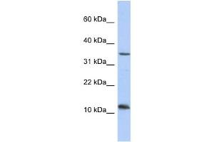 WB Suggested Anti-NXNL2 Antibody Titration: 0. (NXNL2 antibody  (Middle Region))