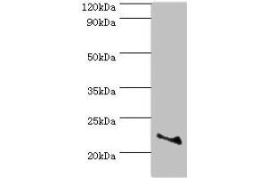 Western blot All lanes: ASF1A antibody at 2 μg/mL + Jurkat whole cell lysate Secondary Goat polyclonal to rabbit IgG at 1/10000 dilution Predicted band size: 23 kDa Observed band size: 23 kDa (ASF1A antibody  (AA 1-204))