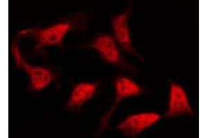 ABIN6267478 staining SW626 by IF/ICC. (CTNNB1 antibody  (pSer33))