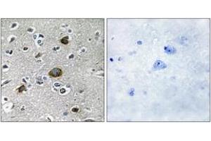 Immunohistochemistry analysis of paraffin-embedded human brain tissue, using AKAP1 Antibody. (AKAP1 antibody  (AA 281-330))