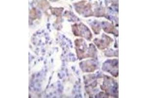 Formalin fixed and paraffin embedded human pancreas tissue stained with Carboxypeptidase B Antibody (N-term) followed by peroxidase conjugation of the secondary antibody and DAB staining. (CPB1 antibody  (N-Term))