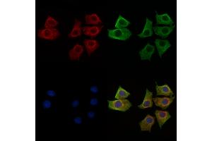 ABIN6262789 and ABIN6269097 staining HepG2 cells by IF/ICC.