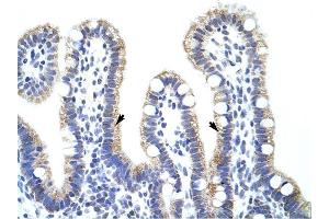 EXOSC10 antibody was used for immunohistochemistry at a concentration of 4-8 ug/ml to stain Epithelial cells of intestinal villus (arrows) in Human Intestine. (EXOSC10 antibody  (C-Term))