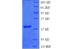 SDS-PAGE (SDS) image for Thrombospondin 2 (THBS2) (AA 19-232), (partial) protein (His tag) (ABIN5710490) (Thrombospondin 2 Protein (THBS2) (AA 19-232, partial) (His tag))