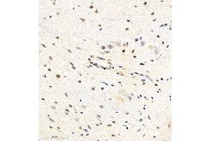 Immunohistochemistry of paraffin embedded mouse spinal cord using USP27 (ABIN7076113) at dilution of 1:700 (400x lens) (USP27X antibody)