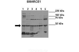 Lanes :  Lane 1: HeLa (human)Lane 2: NHEM (human)Lane 3: Melba (mouse)Lane 4: NIH3T3 (mouse)Lane 5: S16 (rat)Lane 6: H9C2 (rat)   Primary Antibody Dilution :   1:500    Secondary Antibody :  Donkey anti-rabbit-HRP   Secondary Antibody Dilution :   1:5000   Gene Name :  SMARCE1   Submitted by :  Ivana de la Serna, University of Toledo (SMARCE1 antibody  (N-Term))