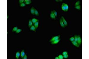 Immunofluorescent analysis of HepG2 cells using ABIN7169226 at dilution of 1:100 and Alexa Fluor 488-congugated AffiniPure Goat Anti-Rabbit IgG(H+L) (WNK2 antibody  (AA 1177-1464))
