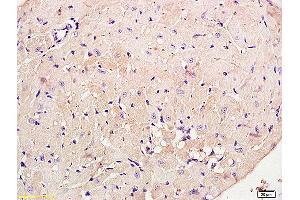 Formalin-fixed and paraffin embedded rat brain labeled with Anti phospho-PI3K p85/PIK3R1(Tyr368) Polyclonal Antibody, Unconjugated (ABIN711041) at 1:200 followed by conjugation to the secondary antibody and DAB staining (PIK3R1 antibody  (pTyr368))