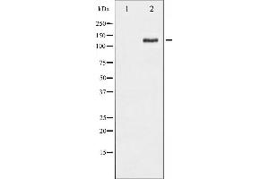 Western blot analysis of FAK phosphorylation expression in PMA treated HepG2 whole cell lysates,The lane on the left is treated with the antigen-specific peptide. (FAK antibody  (pSer843))