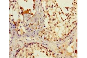 Immunohistochemistry of paraffin-embedded human testis tissue using ABIN7157004 at dilution of 1:100 (IFT80 antibody  (AA 1-268))