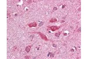 Immunohistochemistry (IHC) image for anti-Toll-Like Receptor 8 (TLR8) (AA 750-850) antibody (ABIN2470503) (TLR8 antibody  (AA 750-850))