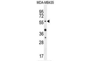 AKT1 (Thr308) Antibody western blot analysis in MDA-MB435 cell line lysates (35µg/lane). (AKT1 antibody  (AA 289-318))
