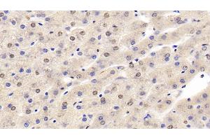 Immunohistochemistry (IHC) image for anti-Hypoxia Inducible Factor 1, alpha Subunit (Basic Helix-Loop-Helix Transcription Factor) (HIF1A) (AA 218-506) antibody (ABIN7426046)