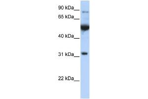 WB Suggested Anti-EIF2B1 Antibody Titration: 0. (EIF2B1 antibody  (C-Term))