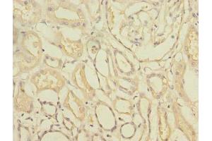Immunohistochemistry of paraffin-embedded human kidney tissue using ABIN7171935 at dilution of 1:100