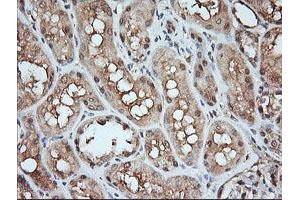 Image no. 2 for anti-Mitogen-Activated Protein Kinase Kinase 1 (MAP2K1) antibody (ABIN1499388) (MEK1 antibody)