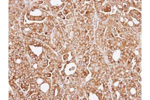 IHC-P Image Immunohistochemical analysis of paraffin-embedded NCI-N87 xenograft, using RPL13A, antibody at 1:100 dilution. (RPL13A antibody)