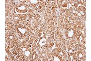 IHC-P Image Immunohistochemical analysis of paraffin-embedded NCI-N87 xenograft, using RPL13A, antibody at 1:100 dilution.