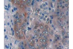 IHC-P analysis of Rat Adrenal gland Tissue, with DAB staining. (CPT1A antibody  (AA 572-773))