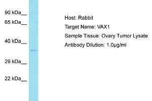 Host: Rabbit Target Name: VAX1 Sample Tissue: Human Ovary Tumor Antibody Dilution: 1ug/ml (VAX1 antibody  (N-Term))