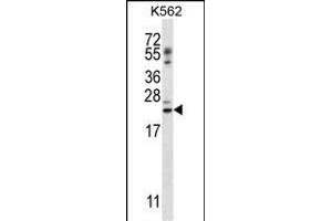 PSORS1C1 Antibody (N-term) (ABIN657118 and ABIN2846264) western blot analysis in K562 cell line lysates (35 μg/lane). (PSORS1C1 antibody  (N-Term))