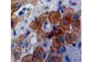 Used in DAB staining on fromalin fixed paraffin-embedded Liver tissue (CXCL11 antibody  (AA 22-94))