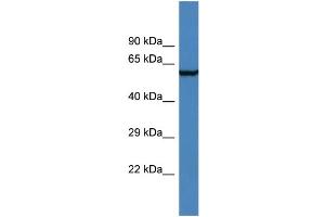Western Blotting (WB) image for anti-Adhesion Molecule with Ig-Like Domain 2 (AMIGO2) (N-Term) antibody (ABIN2786380)