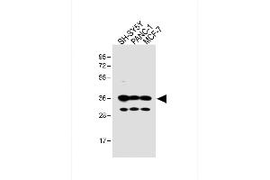 All lanes : Anti-OR5V1 Antibody (C-term) at 1:1000 dilution Lane 1: SH-SY5Y whole cell lysate Lane 2: NC-1 whole cell lysate Lane 3: MCF-7 whole cell lysate Lysates/proteins at 20 μg per lane. (OR5V1 antibody  (C-Term))