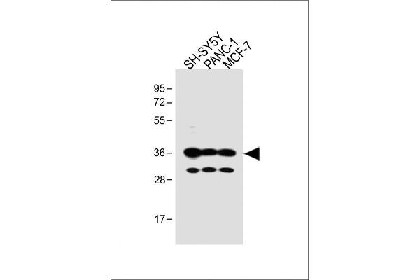 OR5V1 anticorps  (C-Term)