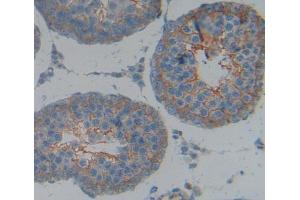 Used in DAB staining on fromalin fixed paraffin- embedded Kidney tissue (KEL antibody  (AA 439-713))