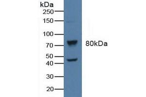 Western blot analysis of Human Raji Cells. (GRK2 antibody  (AA 398-640))