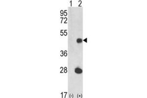 Western Blotting (WB) image for anti-LUC7-Like (LUC7L) antibody (ABIN3002860) (LUC7L antibody)