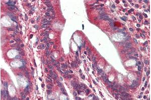 ABIN625816 (5µg/ml) staining of paraffin embedded Human Small Intestine. (SH3GL1 antibody  (Internal Region))