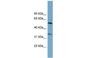 WB Suggested Anti-THNSL2 Antibody Titration: 0. (THNSL2 antibody  (Middle Region))