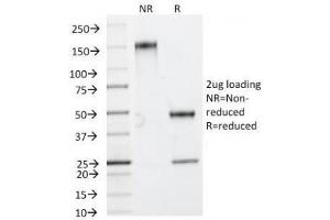 SDS-PAGE Analysis of Purified, BSA-Free HSP27 Antibody (clone HSPB1/774).