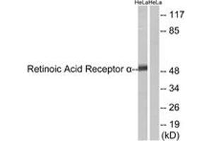 Western blot analysis of extracts from HeLa cells, using Retinoic Acid Receptor alpha (Ab-77) Antibody. (Retinoic Acid Receptor alpha antibody  (AA 46-95))